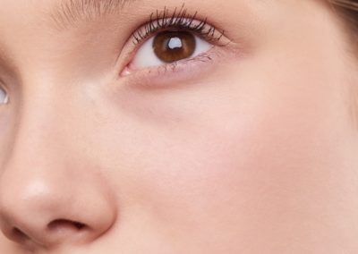 Dysport treatment lexington | The Lift Bar Med Spa