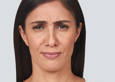 botox clinics near me | The Lift Bar Med Spa