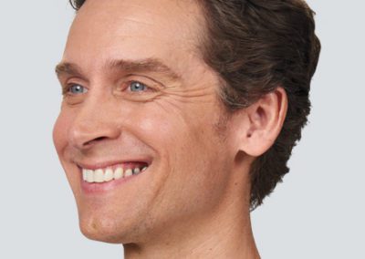Botox injections | The Lift Bar Med Spa