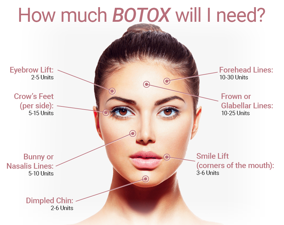 Dysport Nicholasville | The Lift Bar How much Botox will I need | The Lift Bar Med Spa