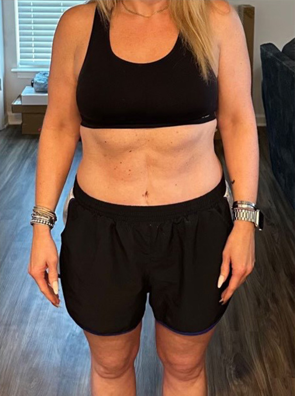 Weight loss