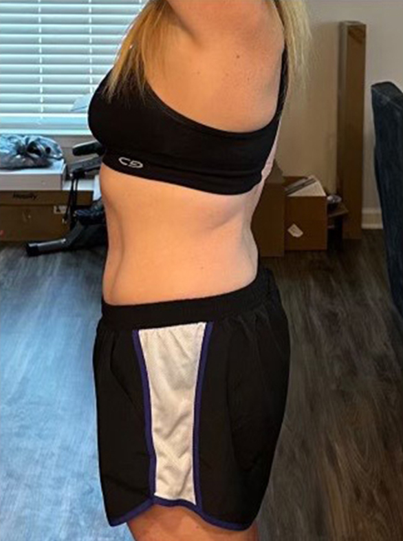 Weight loss