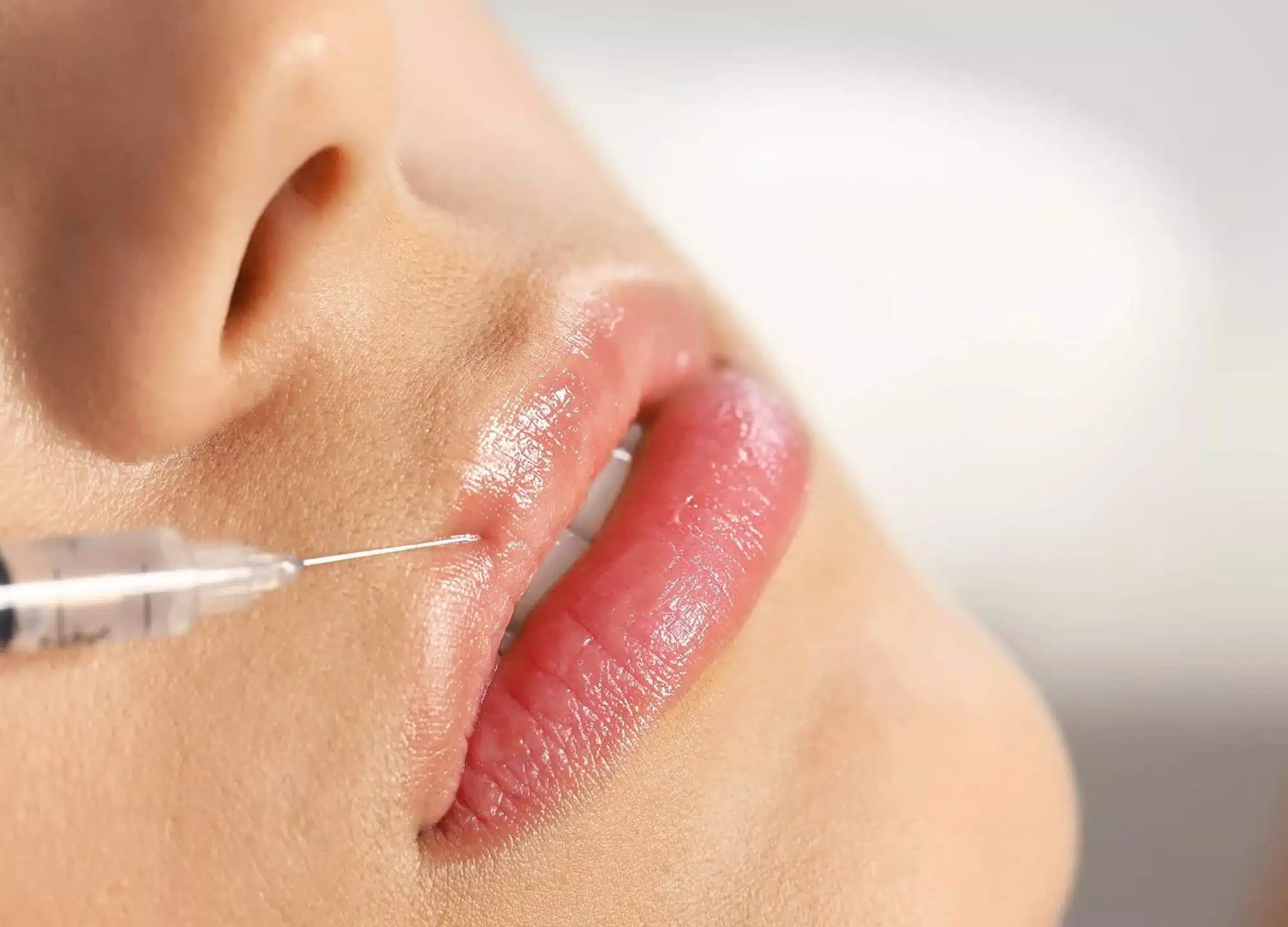 Beautician with a brush applies a white moisturizing mask to the face of a young girl client in a spa beauty salon | The Lift Bar anti aging treatment