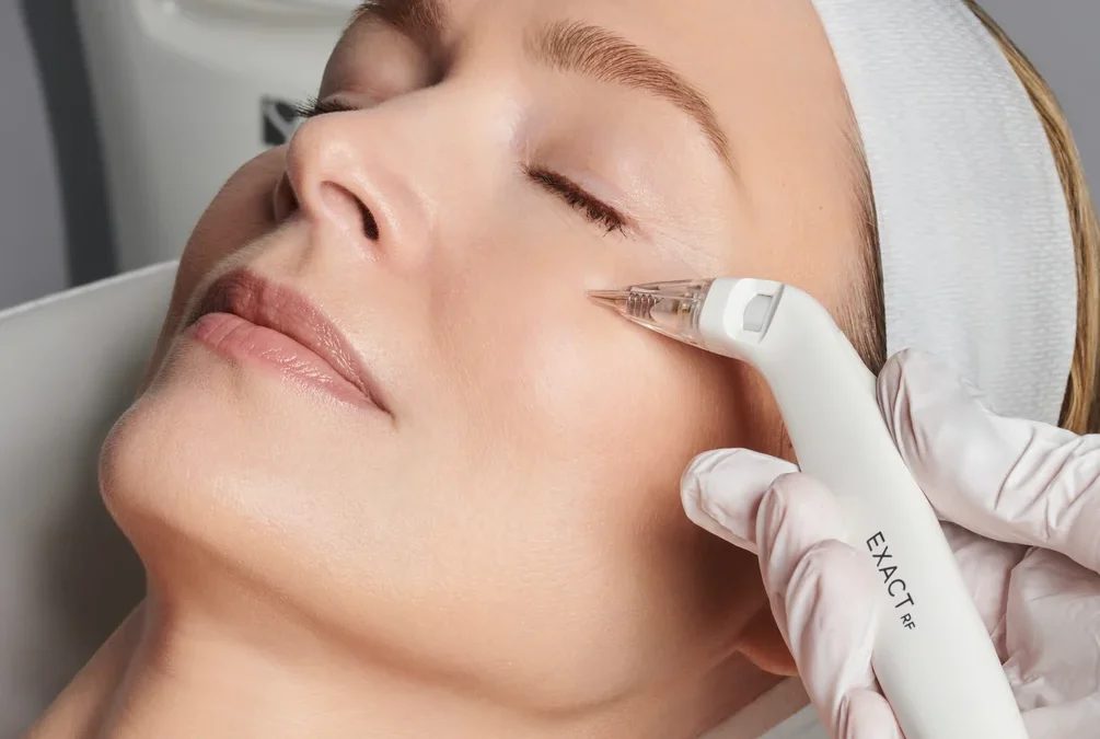 Transform Your Skin with the Tetra CO2 Laser: Comprehensive Treatments at The Lift Bar Med Spa