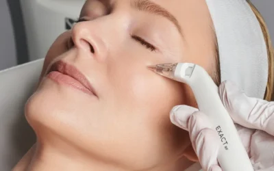 Transform Your Skin with the Tetra CO2 Laser: Comprehensive Treatments at The Lift Bar Med Spa