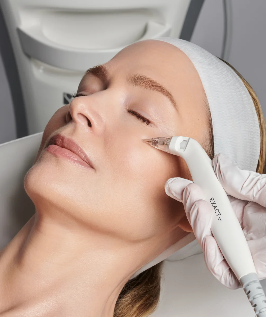 1Stars_CARTESSA7622ret (1) Transform Your Skin with the Tetra CO2 Laser: Comprehensive Treatments at The Lift Bar Med Spa