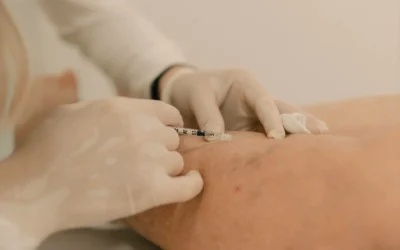 Spider Vein Treatment in Nicholasville & Lexington, KY with Sclerotherapy at The Lift Bar Medspa